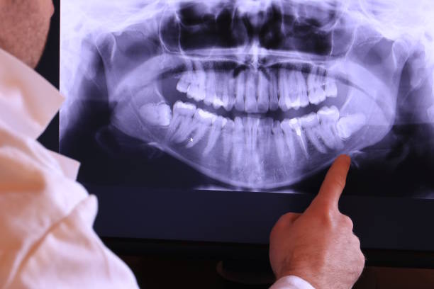 Best Emergency Gum Treatment in East Liverpool, OH